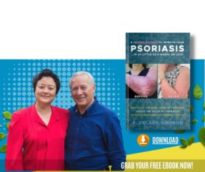 Psoriasis Guide