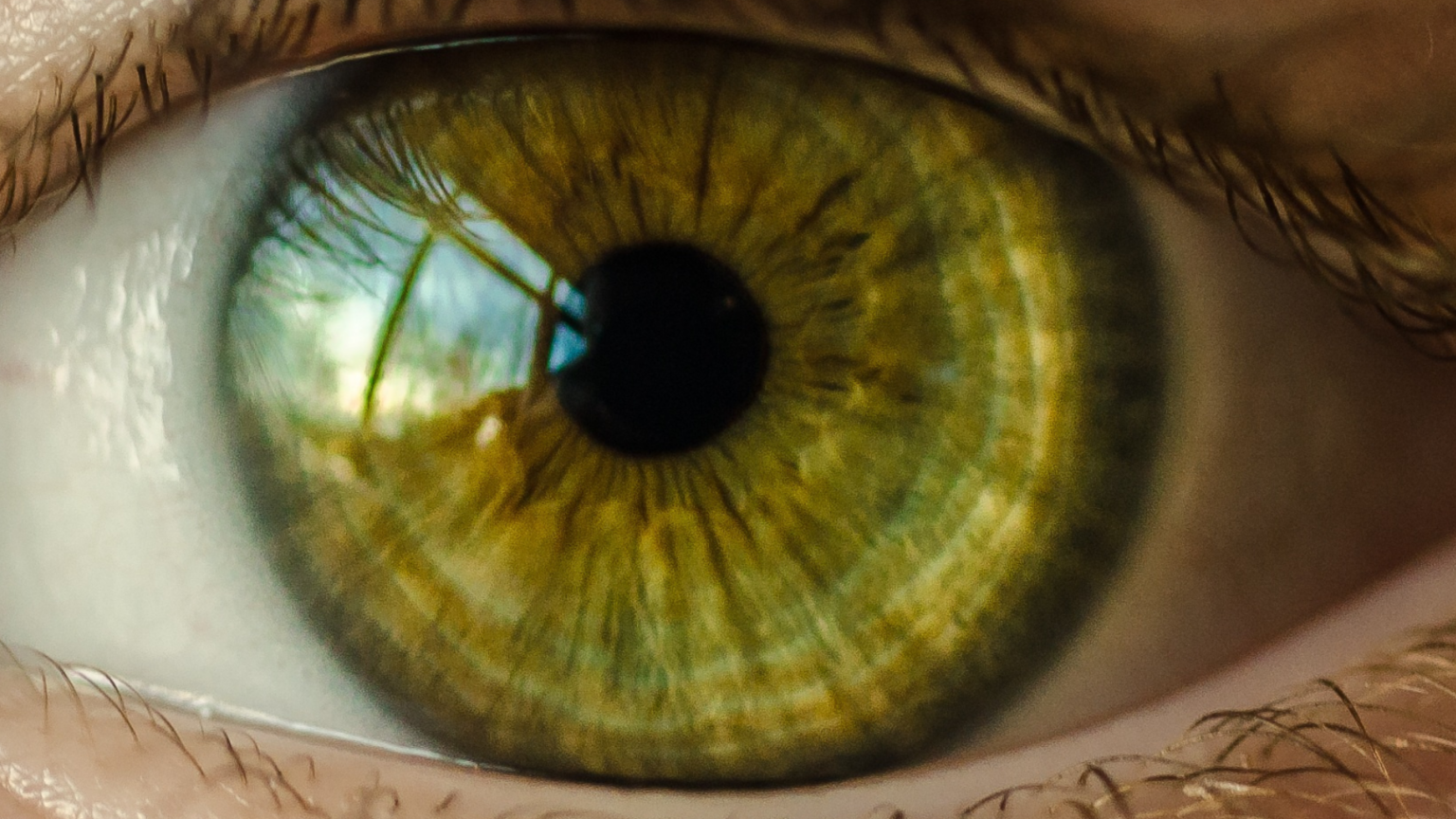 Iridology Pictures and Meanings - Organic Health Solutions