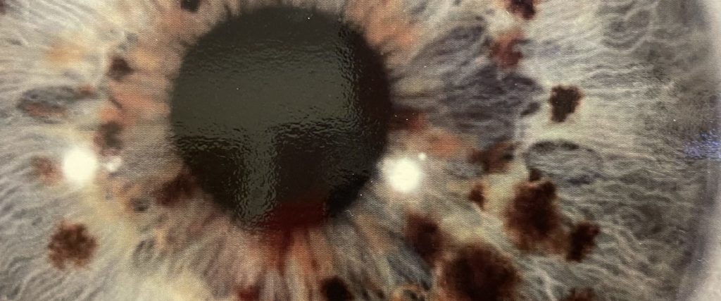 What Can Your Iris Say About Your Health?