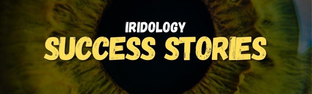 Iridology Success Stories