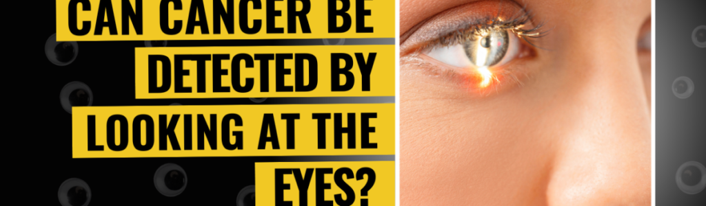 Can Cancer Be Detected By Looking At The Eyes?