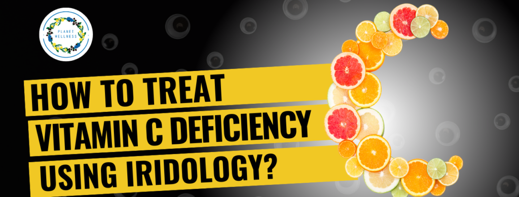 How To Treat Vitamin C Deficiency Using Iridology