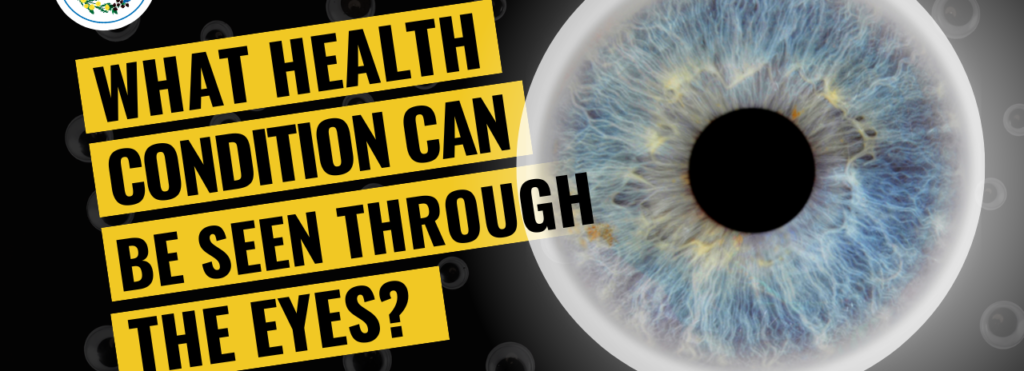 What Health Conditions Can Be Seen Through The Eyes?