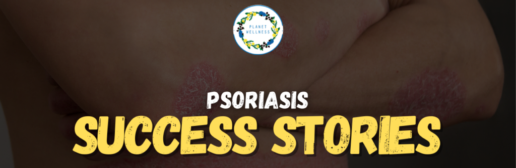 Psoriasis Success Stories