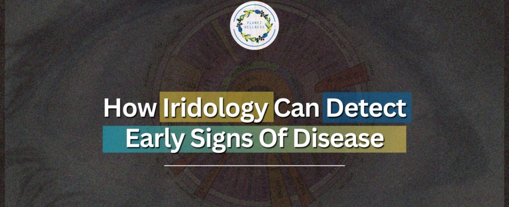 How Iridology Can Detect Early Signs Of Disease