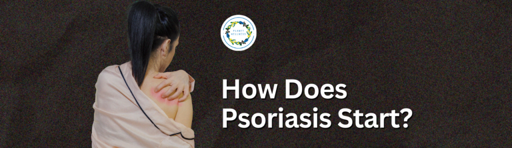 How Does Psoriasis Start?
