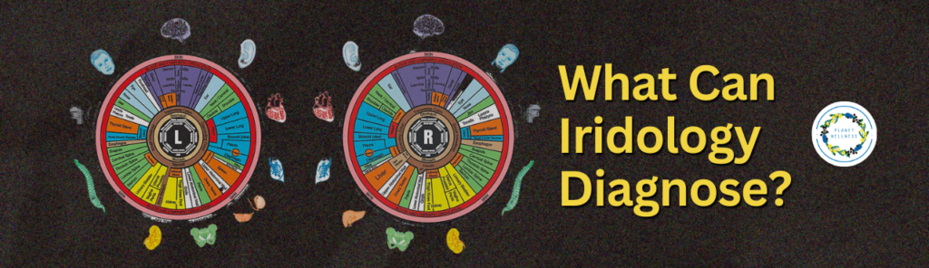 What Can Iridology Diagnose?