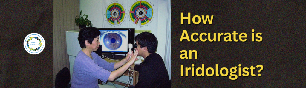 How Accurate Is An Iridologist?