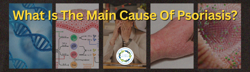 What Is The Main Cause Of Psoriasis?