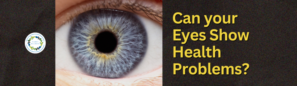 Can Your Eyes Show Health Problems?