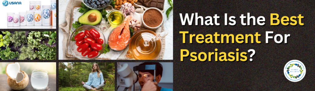 What Is The Best Treatment For Psoriasis?