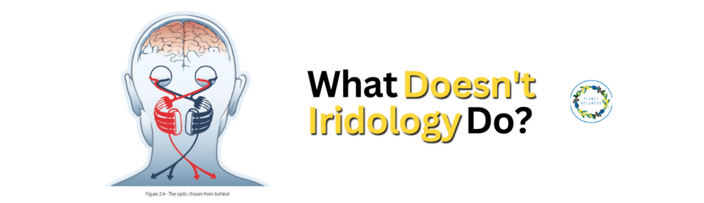 What Doesn’t  Iridology Do?