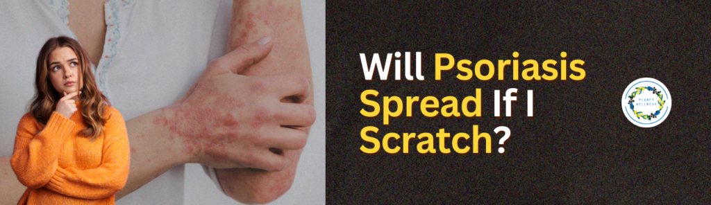 Will Psoriasis Spread If I Scratch?