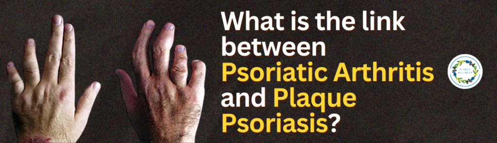 What Is The Link Between Psoriatic Arthritis And Plaque Psoriasis?