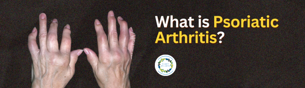 What is Psoriatic Arthritis?