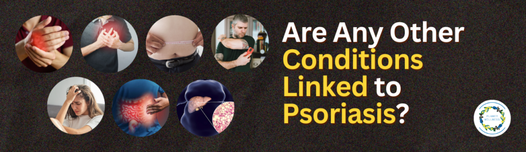 Are any other conditions linked to Psoriasis?