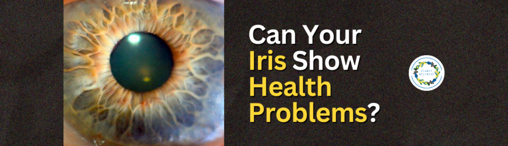 Can Your Iris Show Health Problems?