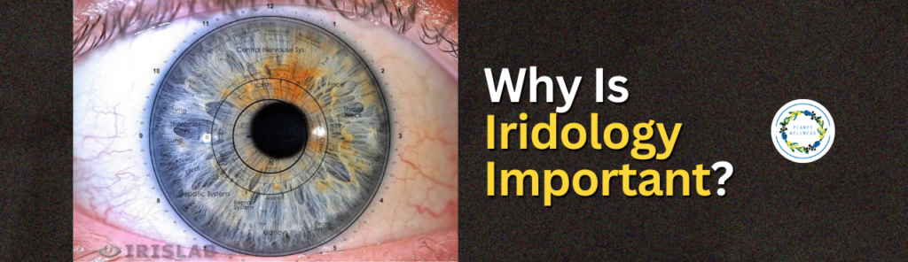 Why Is Iridology Important?