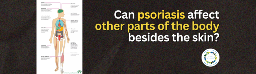 Can Psoriasis Affect Other Parts Of The Body Beside The Skin?