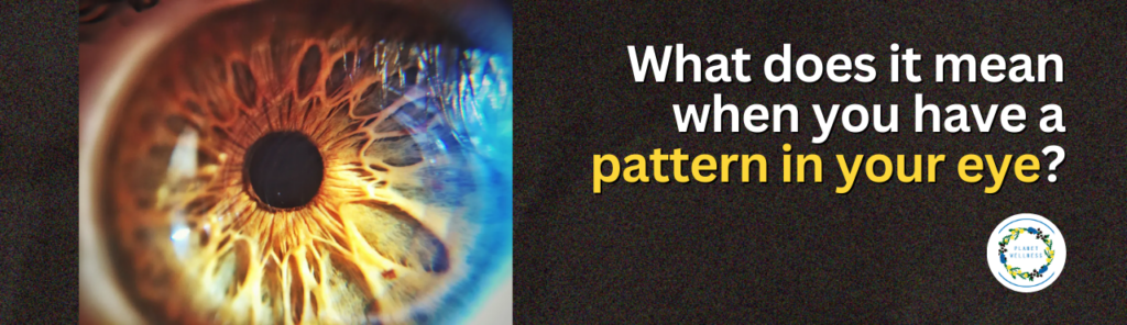 What does it mean when you have a pattern in your eye?