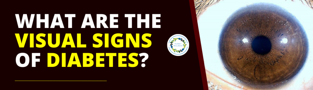 What are the visual signs of Diabetes ?