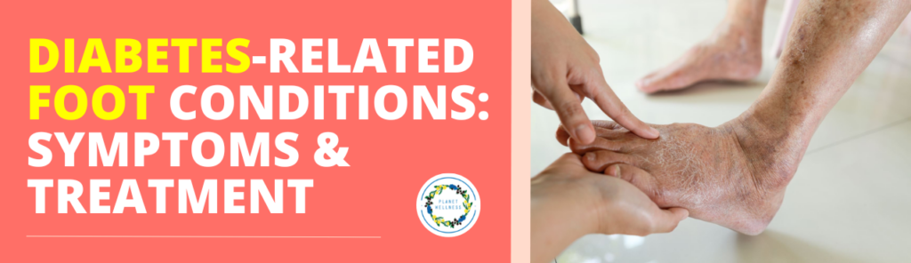 Diabetes Related Foot Conditions – Symptoms and Treatments