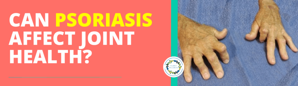 Can Psoriasis affect joint health?