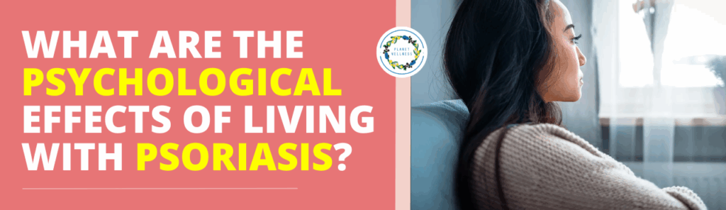 What are the psychological effects of living with Psoriasis?