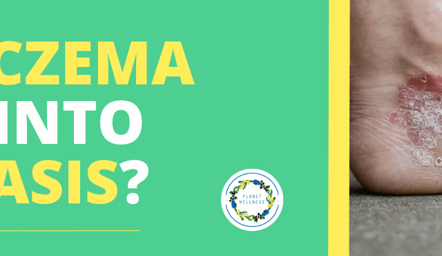 Can Eczema turn into Psoriasis?