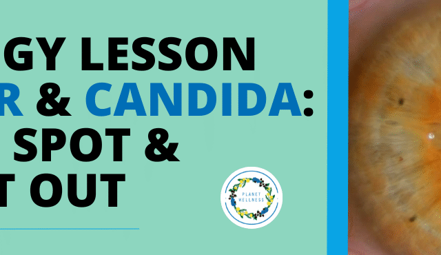 Iridology lesson – Sulphur and Candida How to spot and detox it out