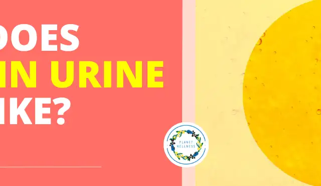 What does sugar in urine look like?