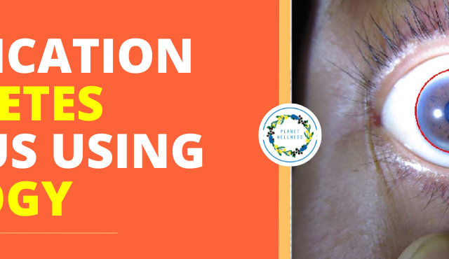 Identification of Diabetes Mellitus using Iridology