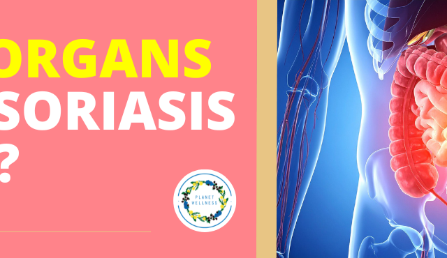 What Organs Does Psoriasis Affect?